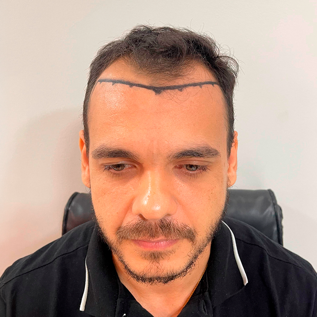 capilos