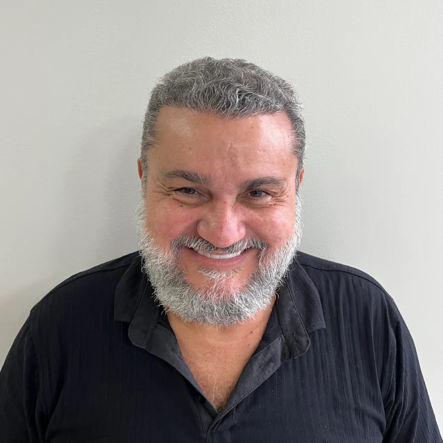 O mesmo paciente depois do transplante capilar