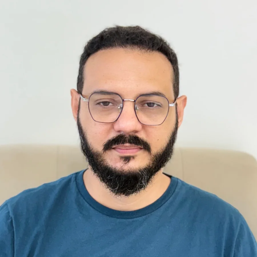 O mesmo paciente depois do transplante capilar