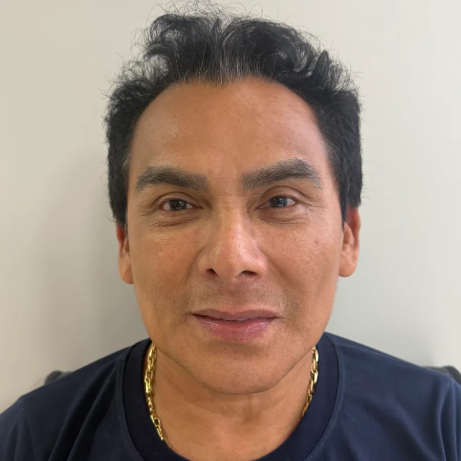 Paciente com linha frontal recuada