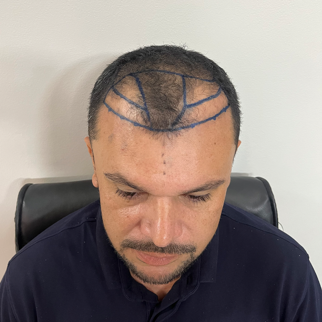 teste2.png