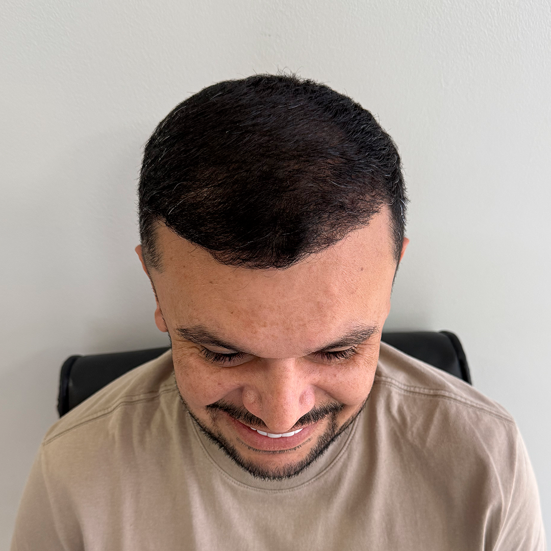 teste23.png